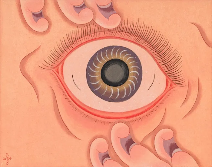 Tseng Chien-Ying, Distichiasis