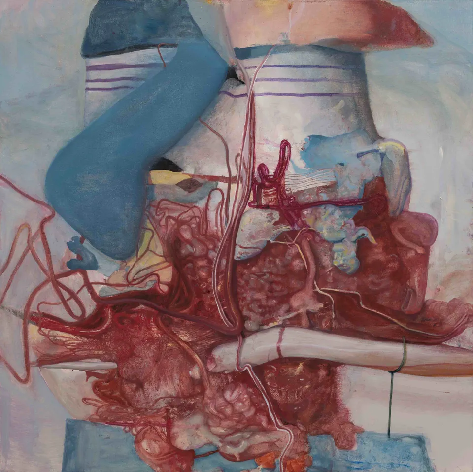 Keunmin Lee, Overturned Flowerpot